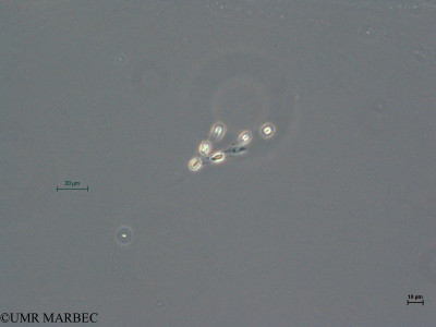 phyto/Thau_Lagoon/THAU_station1/GELAMED 2010/Dinobryon balticum  (copy)_thumb.jpg